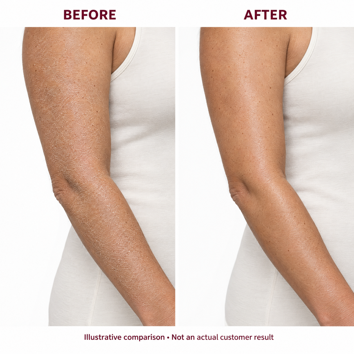 G02 — Illustrative dry-looking versus moisturized-looking arm, standing side view in a white studio. Not an actual customer result.